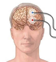 electrodes.jpg