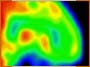 mri-pic.jpg